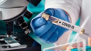 Bogotá cuenta con 100 mil nuevas pruebas PCR para diagnóstico de COVID-19