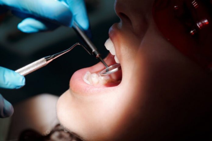 Odontólogo rompía los dientes de sus pacientes para cobrar más