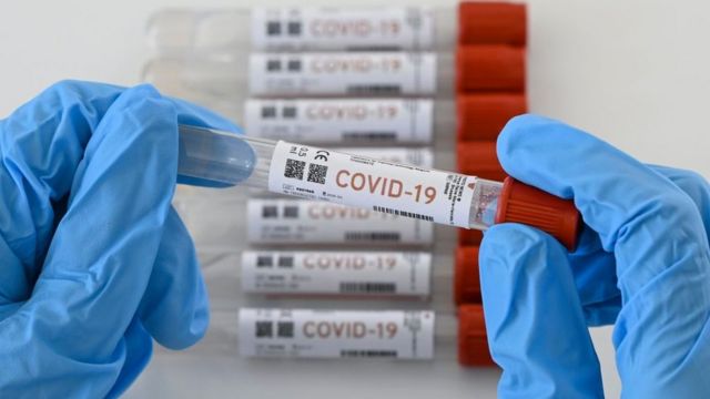 Los contagios y muertes por Covid-19 aumentan en Cundinamarca