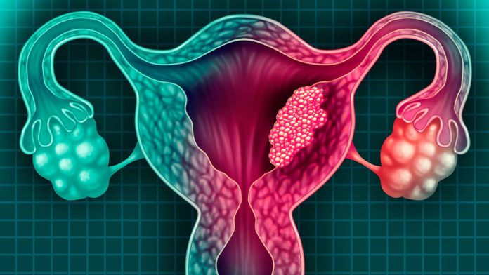 Además, es importante que las mujeres estén informadas sobre los factores de riesgo y los síntomas del cáncer de cuello uterino, y que consulten a su médico si notan cualquier cambio en su cuerpo.