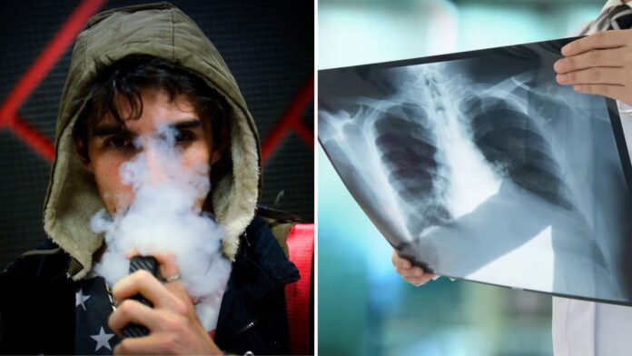 Trágica tendencia: Jóvenes mueren de problemas pulmonares por vapeo